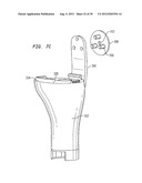 SOFT TISSUE ATTACHMENT MECHANISM diagram and image