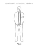 GARMENT FOR TUBING MANAGEMENT diagram and image