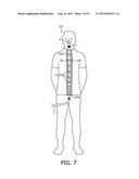 GARMENT FOR TUBING MANAGEMENT diagram and image