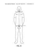 GARMENT FOR TUBING MANAGEMENT diagram and image