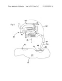 HOT PLATE WELDING SYSTEM diagram and image