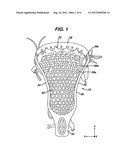 LACROSSE HEAD POCKET RETAINER diagram and image