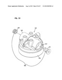 LIQUID FILTER ASSEMBLIES; FEATURES; COMPONENTS; AND, METHODS diagram and image