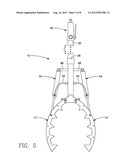 Rock Grasping and Removal Apparatus diagram and image