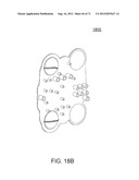 PUMPING CASSETTE diagram and image