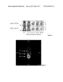 NEUROTENSIN ANALOGUES FOR RADIOISOTOPE TARGETING TO NEUROTENSIN     RECEPTOR-POSITIVE TUMORS diagram and image