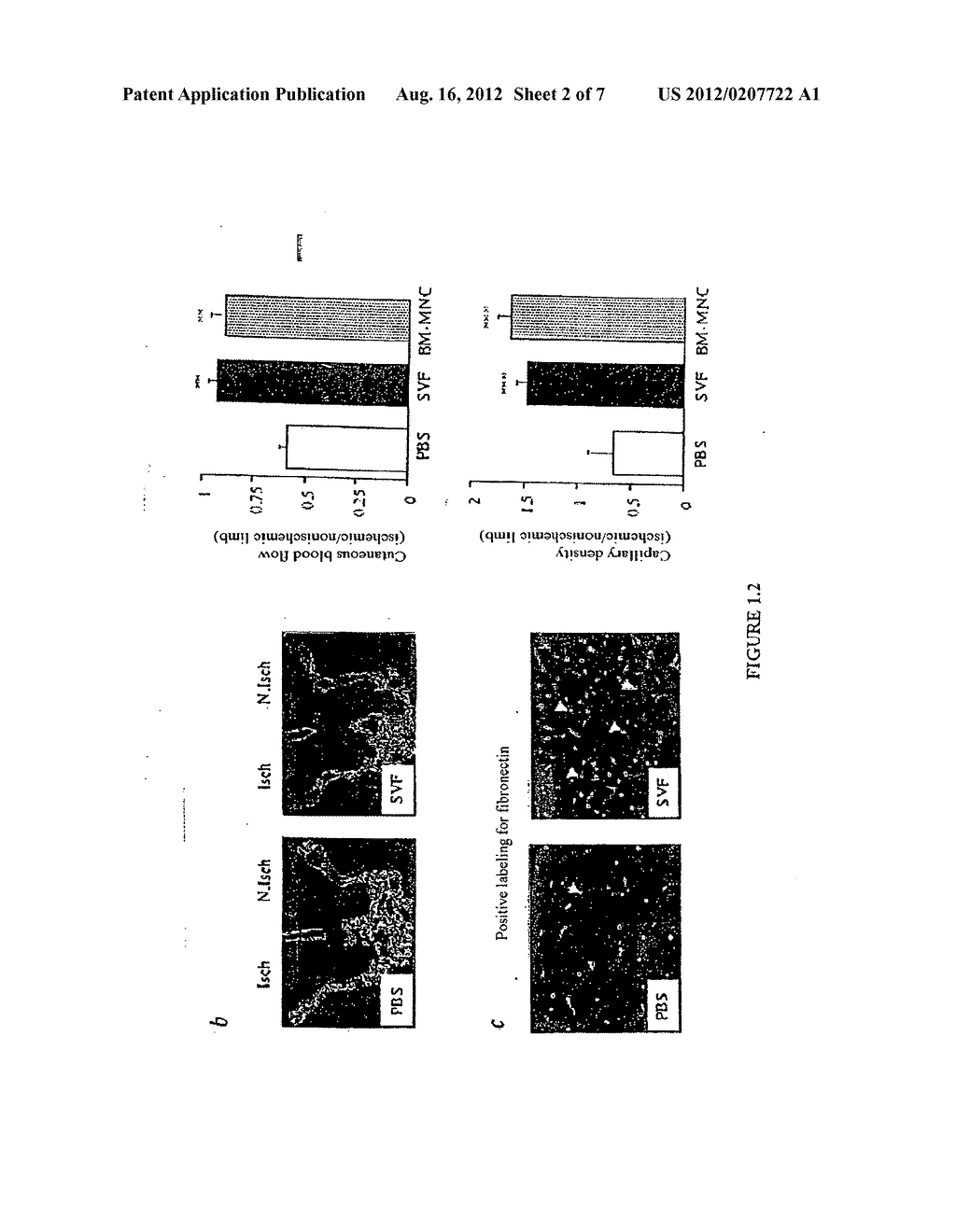 Use Of Adipose Tissue Cells For Initiating The Formation Of A Functional     Vascular Network - diagram, schematic, and image 03