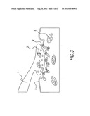 Method and system for effecting changes in pigmented tissue diagram and image