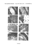 COMPOSITIONS AND METHODS FOR WOUND HEALING diagram and image