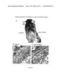 COMPOSITIONS AND METHODS FOR WOUND HEALING diagram and image