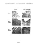 COMPOSITIONS AND METHODS FOR WOUND HEALING diagram and image