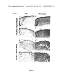 COMPOSITIONS AND METHODS FOR WOUND HEALING diagram and image