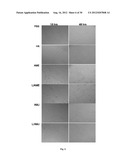 Amniotic Membrane Preparations and Purified Compositions and Therapy for     Scar Reversal and Inhibition diagram and image