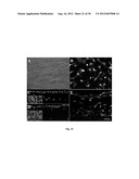 Amniotic Membrane Preparations and Purified Compositions and Therapy for     Scar Reversal and Inhibition diagram and image