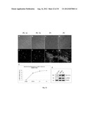 Amniotic Membrane Preparations and Purified Compositions and Therapy for     Scar Reversal and Inhibition diagram and image