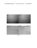 Amniotic Membrane Preparations and Purified Compositions and Therapy for     Scar Reversal and Inhibition diagram and image