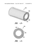 Fabric Reinforced Rubber Article Having Pattern Coated Reinforcement     Fabric diagram and image