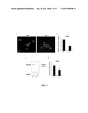 DIAGNOSTIC AND TREATMENT FOR CHRONIC AND ACUTE PHASE MYELOID LEUKEMIA diagram and image