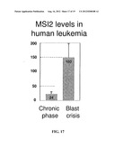 DIAGNOSTIC AND TREATMENT FOR CHRONIC AND ACUTE PHASE MYELOID LEUKEMIA diagram and image