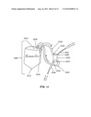 Non-Dispersive Process for Insoluble Oil Recovery from Aqueous Slurries diagram and image