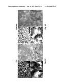 Carcinoma Homing Peptide (CHP), Its Analogs, and Methods of Using diagram and image