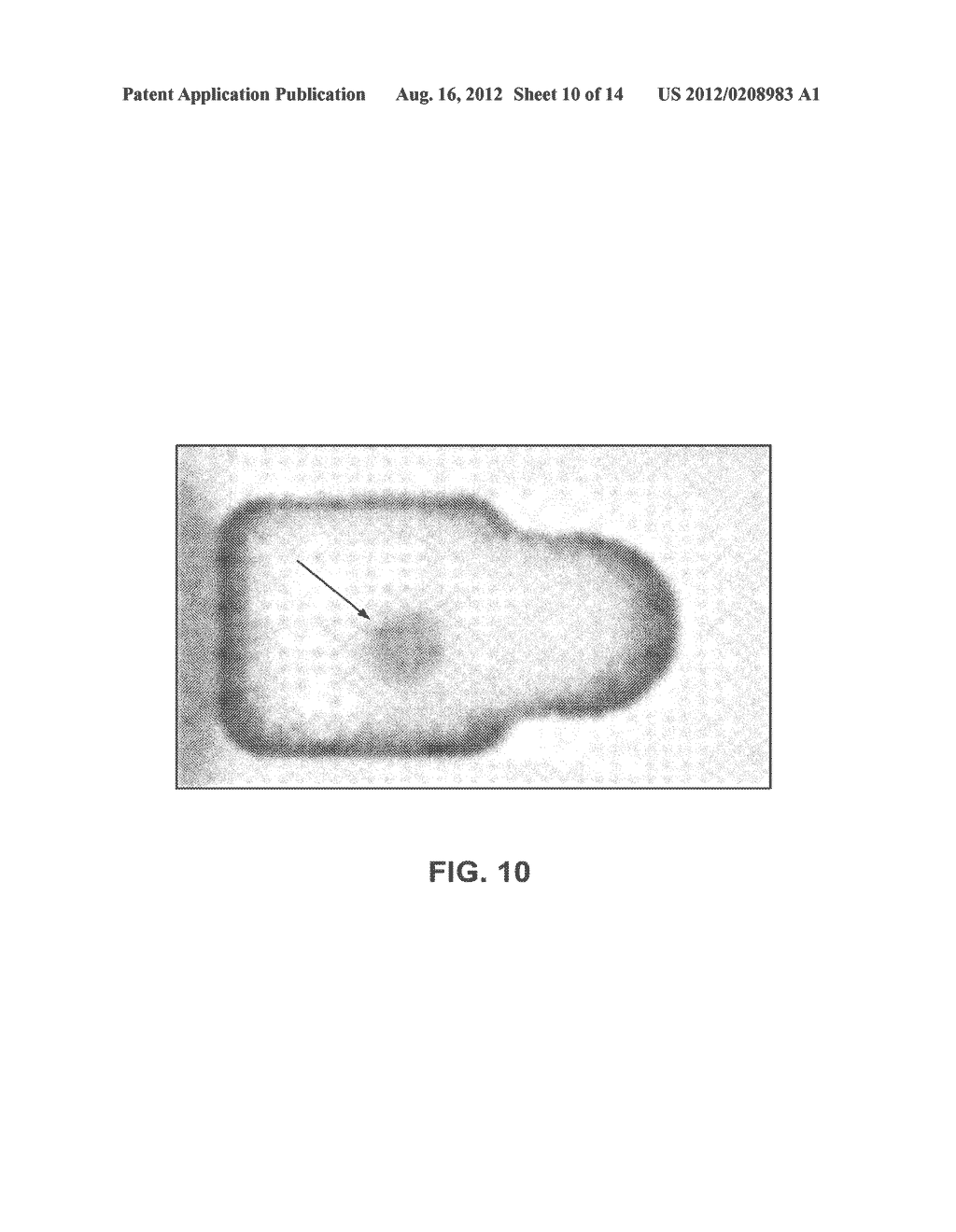 METHODS, DEVICES, KITS AND COMPOSITIONS FOR DETECTING WHIPWORM - diagram, schematic, and image 11