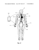 CONTINUOUS NON-INTERFERING HEALTH MONITORING AND ALERT SYSTEM diagram and image