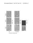 Systems and Methods for Ultrasound Imaging and Insonation of Microbubbles diagram and image