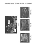 Systems and Methods for Ultrasound Imaging and Insonation of Microbubbles diagram and image