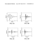 Systems and Methods for Ultrasound Imaging and Insonation of Microbubbles diagram and image