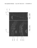 Systems and Methods for Ultrasound Imaging and Insonation of Microbubbles diagram and image