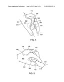 ULTRASOUND PROBE INCLUDING A SECURING MEMBER diagram and image