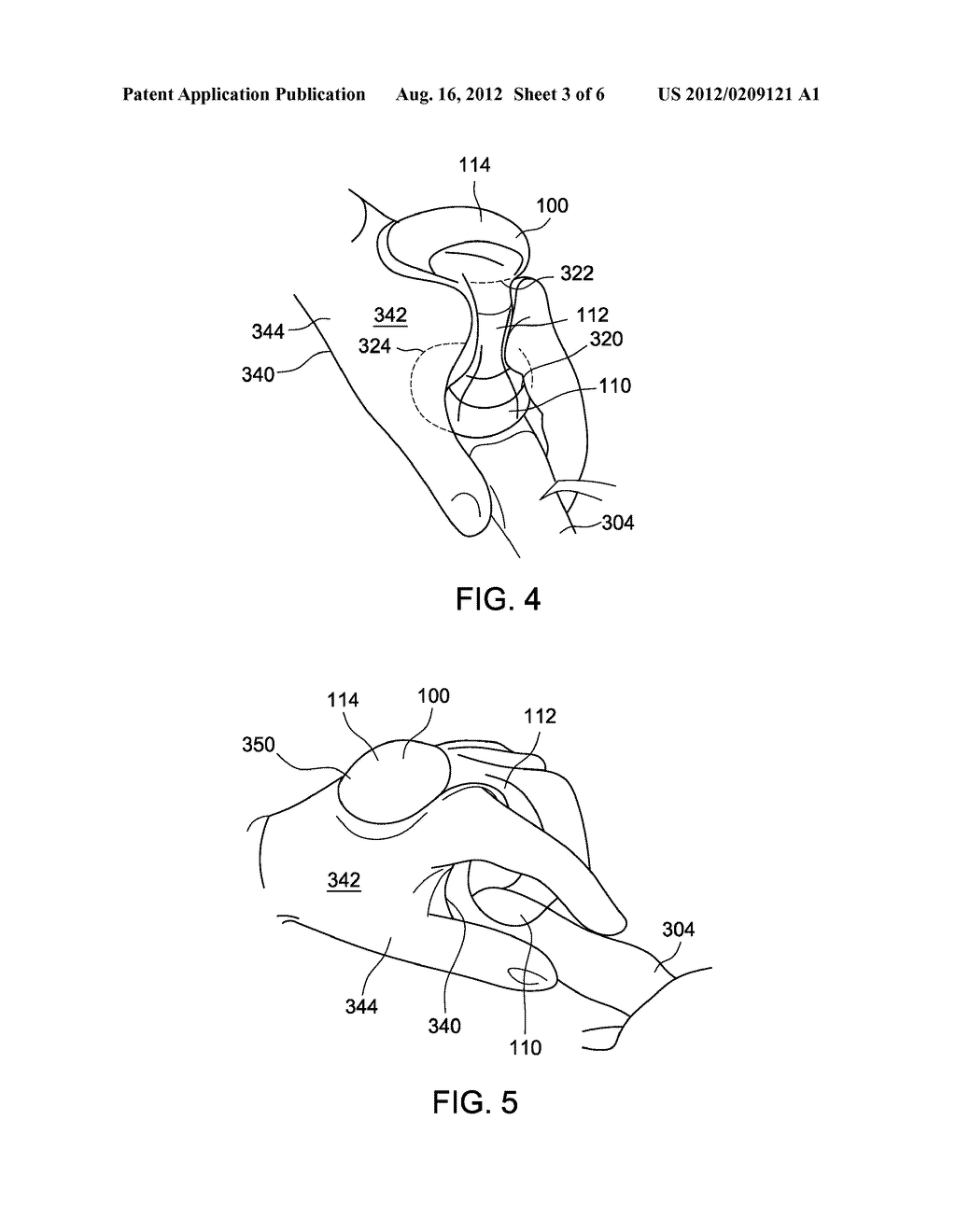 ULTRASOUND PROBE INCLUDING A SECURING MEMBER - diagram, schematic, and image 04