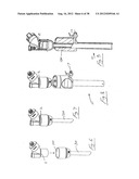 INSUFFLATION SYSTEM diagram and image