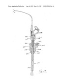 INSUFFLATION SYSTEM diagram and image