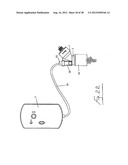 INSUFFLATION SYSTEM diagram and image