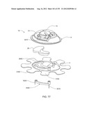 PATCH-SIZED FLUID DELIVERY SYSTEMS AND METHODS diagram and image