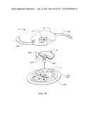 PATCH-SIZED FLUID DELIVERY SYSTEMS AND METHODS diagram and image