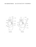 PATCH-SIZED FLUID DELIVERY SYSTEMS AND METHODS diagram and image