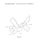 PATCH-SIZED FLUID DELIVERY SYSTEMS AND METHODS diagram and image