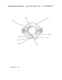 TROCAR STABILITY ASSEMBLY diagram and image