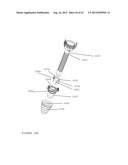 TROCAR STABILITY ASSEMBLY diagram and image