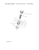 TROCAR STABILITY ASSEMBLY diagram and image