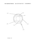 TROCAR STABILITY ASSEMBLY diagram and image