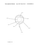 TROCAR STABILITY ASSEMBLY diagram and image