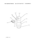 TROCAR STABILITY ASSEMBLY diagram and image