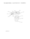 TROCAR STABILITY ASSEMBLY diagram and image