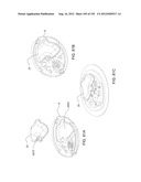 Adhesive and Peripheral Systems and Methods for Medical Devices diagram and image