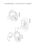 Adhesive and Peripheral Systems and Methods for Medical Devices diagram and image