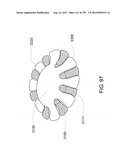 Adhesive and Peripheral Systems and Methods for Medical Devices diagram and image